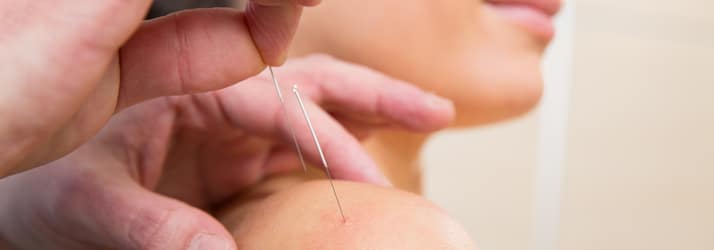 Chiropractic Kearny Mesa CA Acupuncture